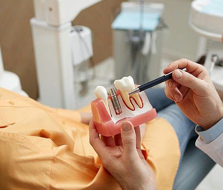 Como escolher o melhor seguro dentário para implantes
