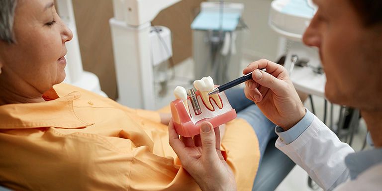 Como escolher o melhor seguro dentário para implantes