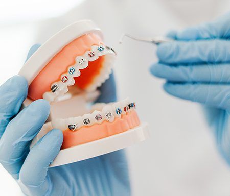 Como escolher o melhor seguro dentário para aparelho?